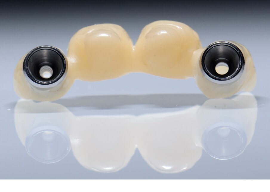 Fig. 60 - Provvisorio e precisione.