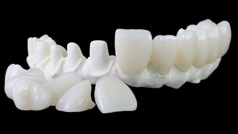 MAGICAL All on FOUR: chirurg, zubní lékař a zubní technik představují svůj unikátní postup