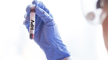 Cancer drug may help treat human papillomavirus infections, study finds