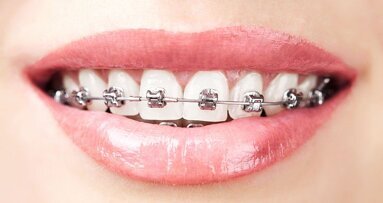 OVAP verder onder nieuwe verenigingsnaam