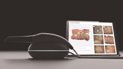 3DISC reinvents the intra-oral scanner with OVO 3DISC reinvents the intra-oral scanner with OVO