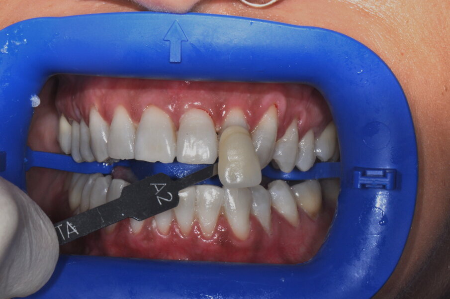 Fig. 4 - Posizionamento del colore rilevato a tempo zero in modo da verificare il risultato.
