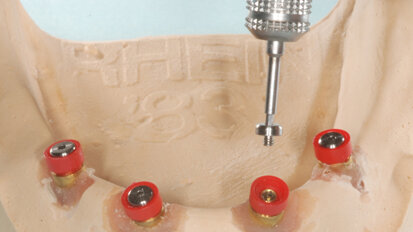 Ot Cap normo-micro e Ot Equator. Attacchi a sfera filettati intercambiabili con guaina da incollare