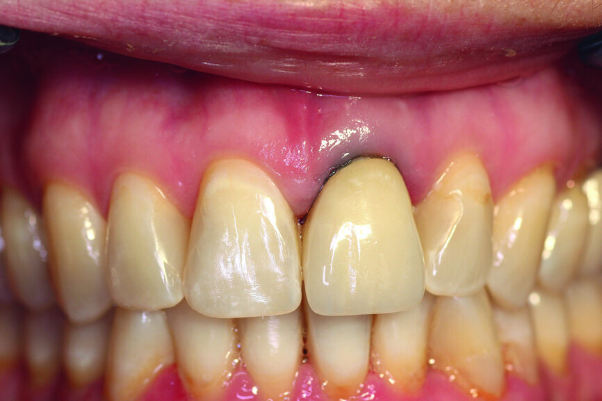 Fig. 1: Initial clinical situation.