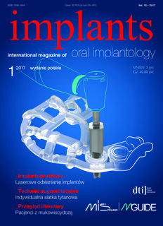 implants Poland No. 1, 2017