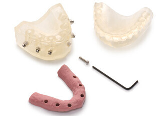 Materialise Dental: Top-notch backward planning – with Immediate Smile