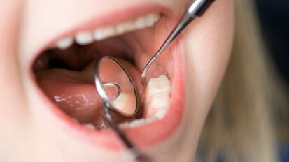 Nederlander vaker naar tandarts