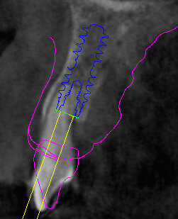 Fig. 13 - Cross impianto 2.2.