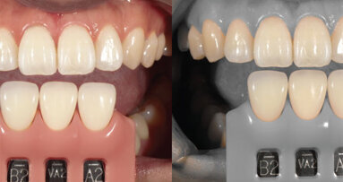 A digital camera designed just for dentists’ clinical photography, case documentation