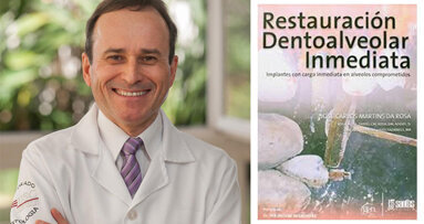 Η έξυπνη τεχνική τοποθέτησης εμφυτεύματος IDR