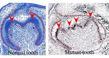 Notwendiges Gen für die Zahnbildung entdeckt