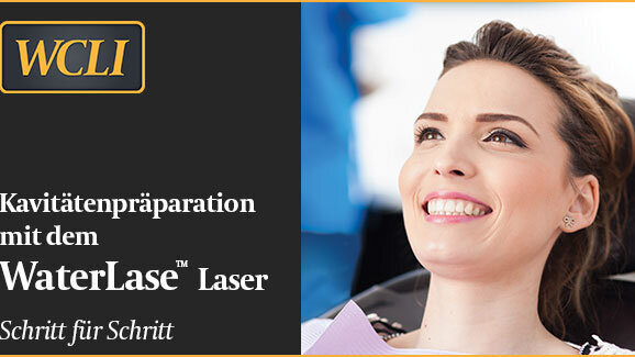 Kavitätenpräparation mit dem Laser – Schritt für Schritt