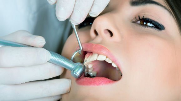 Forte, seguro e não corrosivo: óxido de grafeno testado para aplicação em odontologia