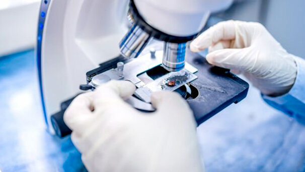 Scienziati neozelandesi sviluppano un nuovo metodo per preservare i denti cariati