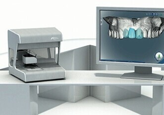 Nobel Biocare – NobelProcera 2G System