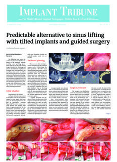 Implant Tribune Middle East & Africa No.4, 2022