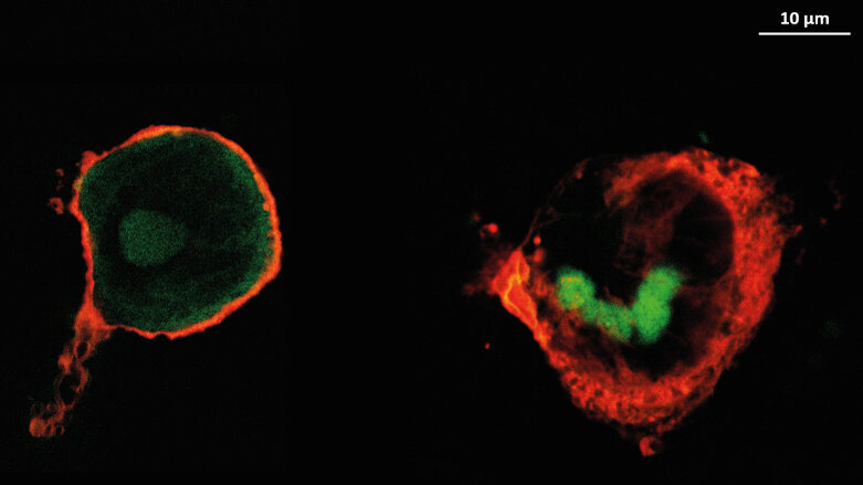 Des revêtements anti-inflammatoires pour réduire les complications post-opératoires implantaires