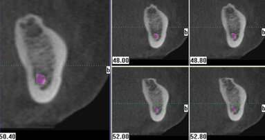 Cone beam — awareness in three dimensions