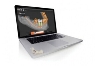 SimPlant® GO SimPlant® GO