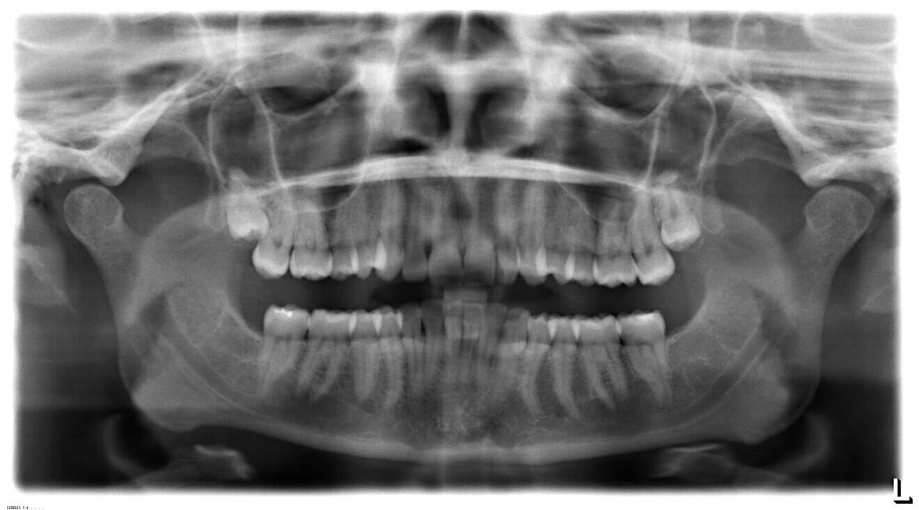 Fig. 2: Panoramic radiograph.