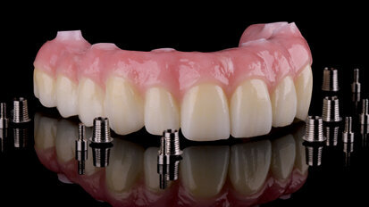 Titanové báze – nové možnosti osvědčených mezostruktur