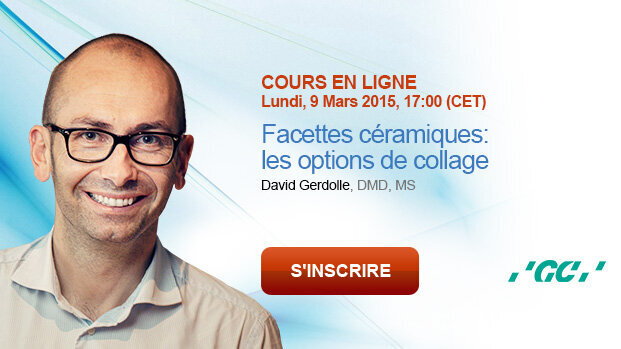 Webinaire « Facettes céramiques: les options de collage »