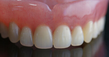 Quality of life study of denture and dental implant patients launched