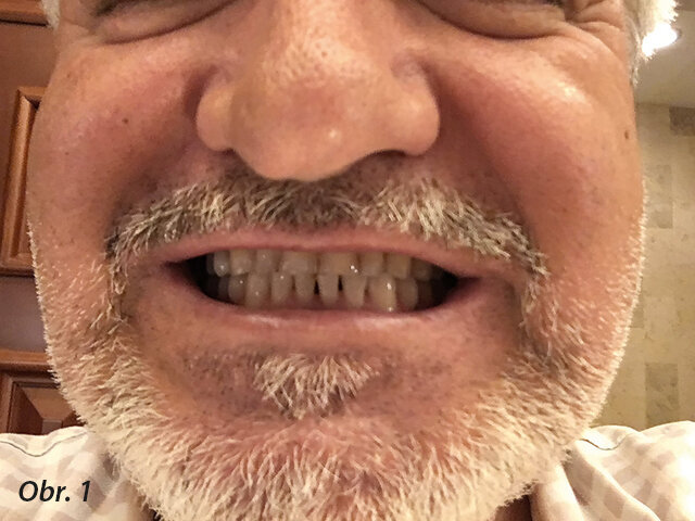 Obr. 1: Pacientova „selfie“ fotografie