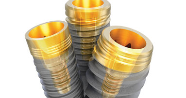 Trusted implant designs, united in one connection