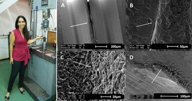 Novo estudo sugere que muitos implantes dentários podem ser propensos à fratura