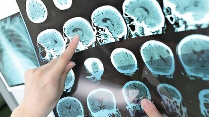 Споменът от денталното лечение преследва съзнанието на неспокойните пациенти