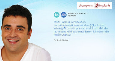 Extraktion und Implantation in einer Sitzung: Experte erklärt Vorteile