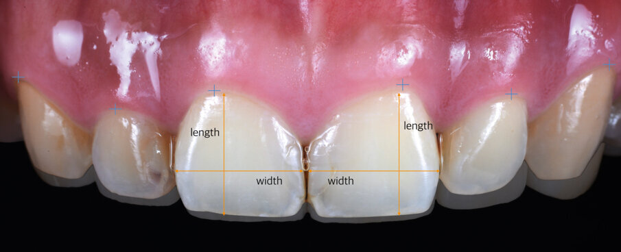 Fig. 1: Preoperative view