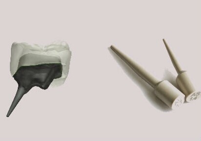 3Shape – Post and Core