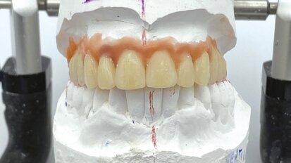 Toronto a carico immediato: un nuovo modo di interpretare vecchi concetti ottenendo il massimo da ognuno di essi