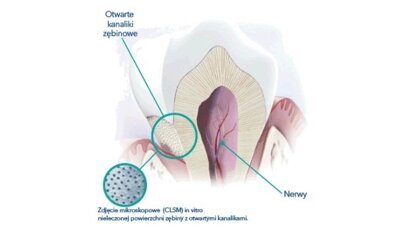 Profesjonalne sposoby na nadwrażliwość zębów