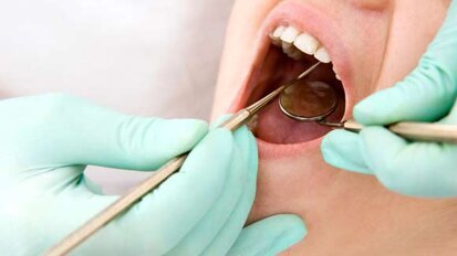 „Parodontitisepidemie“ ohne Konsequenzen