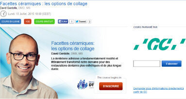 Webinaire « Facettes céramiques : les options de collage »