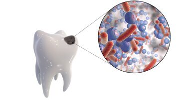 Si può crescere senza carie a costo 0 o con pochi centesimi al giorno