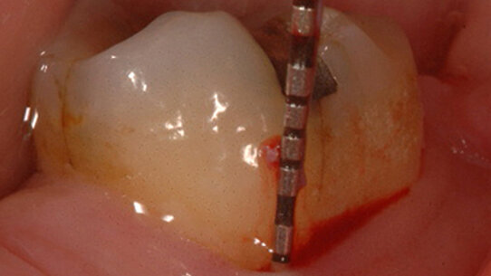 AIE propone: Caso Clinico 2
