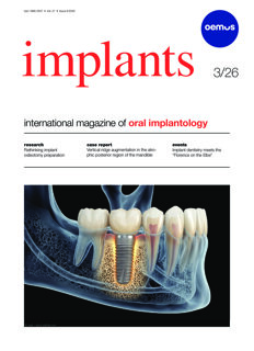implants-international-no-3-2026