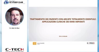 Trattamento dei pazienti con arcate totalmente edentule: applicazioni cliniche dei mini impianti