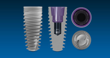 Mini-fellowship in implant dentistry to be offered at University of Miami