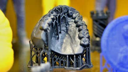 Kako tehnologija 3D štampanja i ugao štampanja utiču na tačnost dentalnih odlivaka