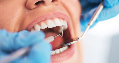 Research on using oral bacteria transplant to prevent tooth decay