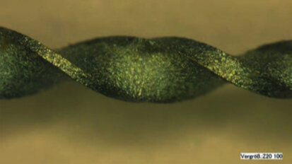 Παρακολούθηση ενδοδοντικών περιστατικών με έντονες κάμψεις στους ριζικούς σωλήνες, του Dr Thomas Rieger