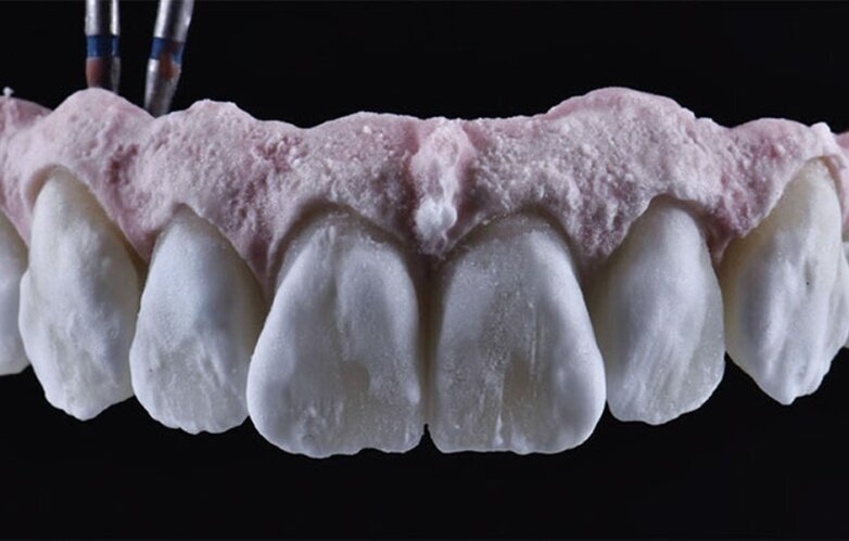 Keramická náhrada před posledním pálením