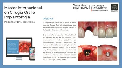 Primer Máster Internacional ONLINE en Cirugía Oral e lmplantología