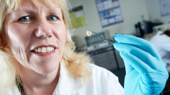 Victorian baby teeth could help predict future health of children today