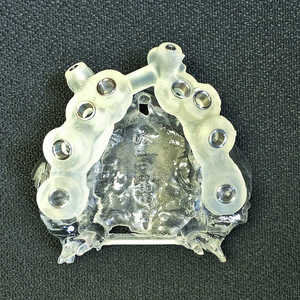 Fig-7-Guide-chirurgical-pour-implants-maxillaires-300x300-